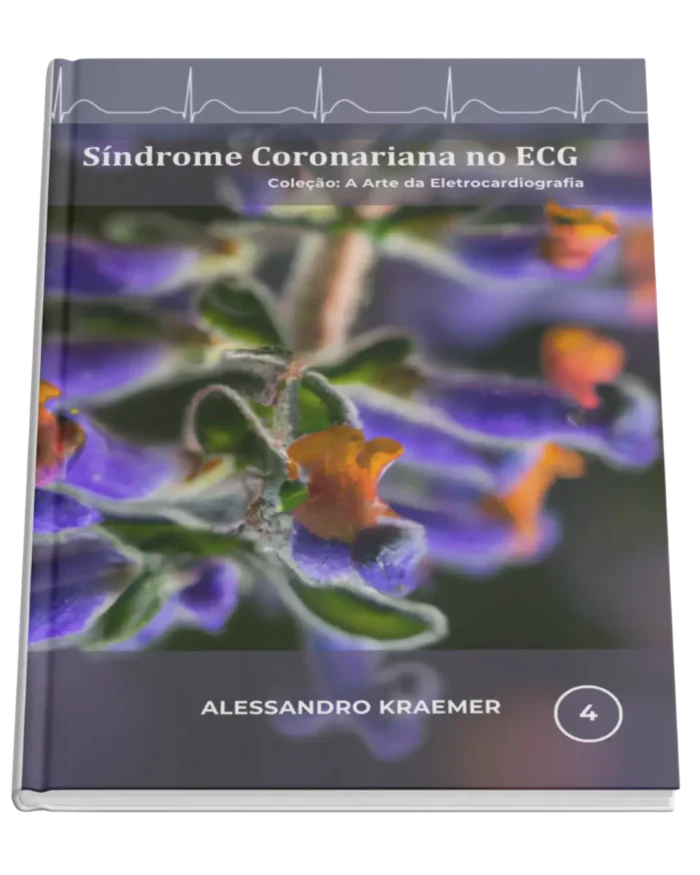 Livro 4 - Síndrome Coronariana no ECG