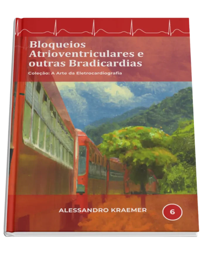 Livro 6 - Bloqueios Atrioventriculares e Outras Bradicardias