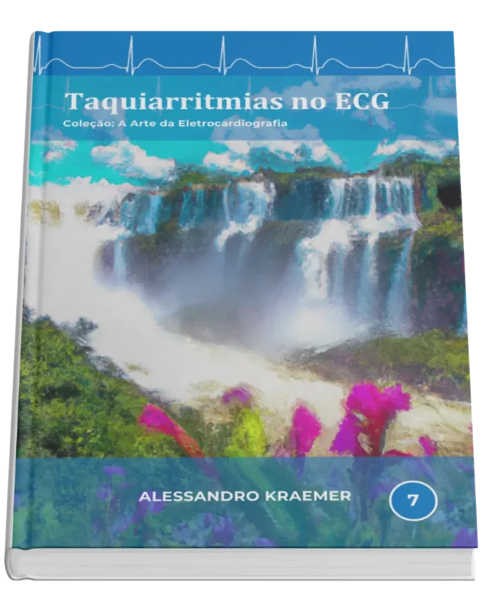 Livro 7 - Taquiarritmias no ECG
