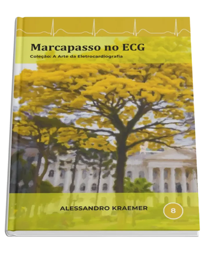 Livro 8 - Marcapasso no ECG
